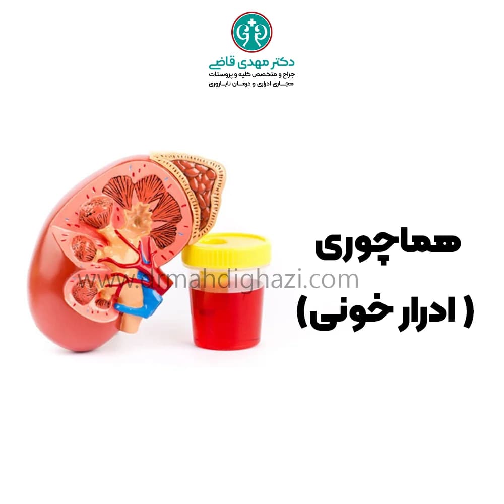 دکتر قاضی -ادرار خونی (هماچوری)