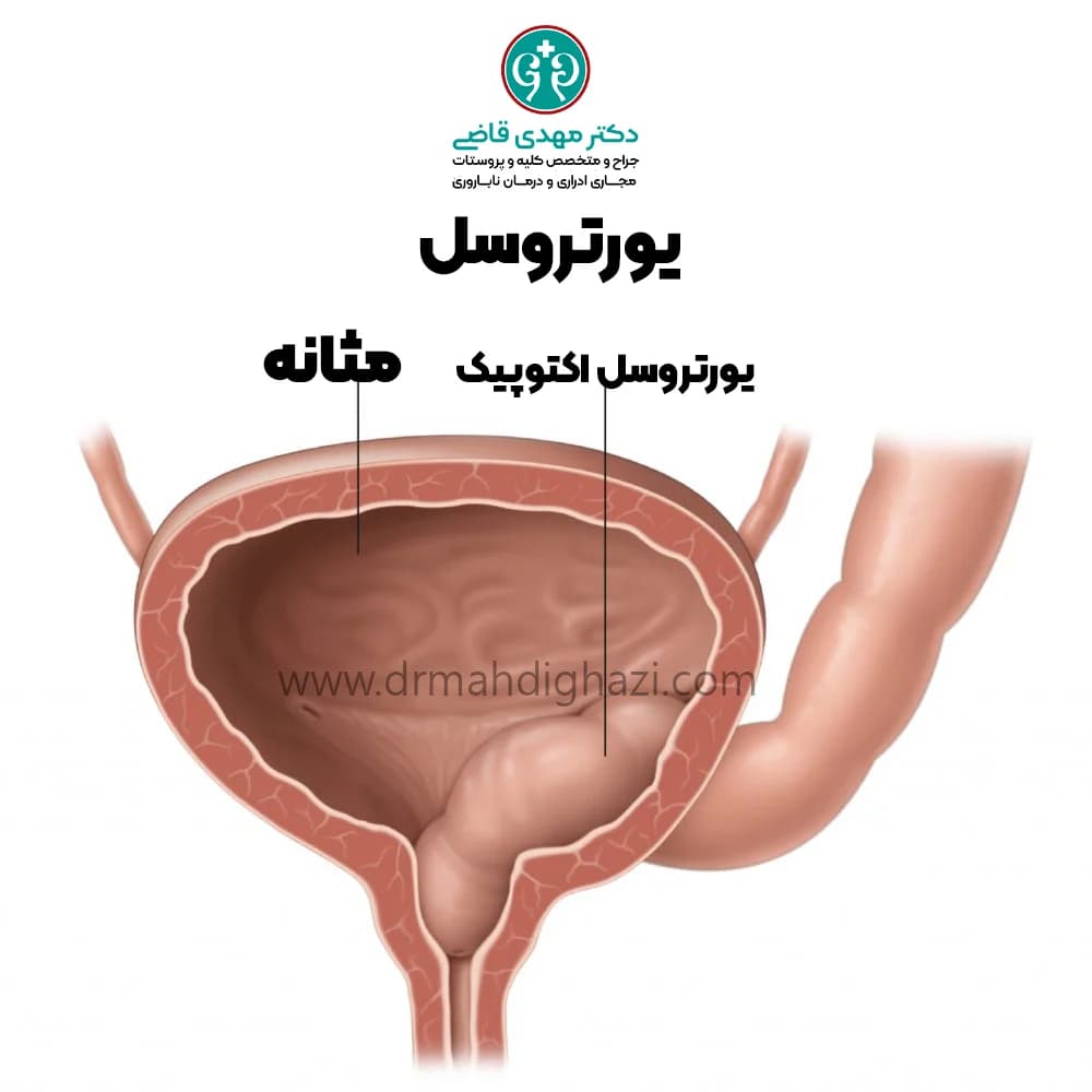 دکتر قاضی-یورتروسل