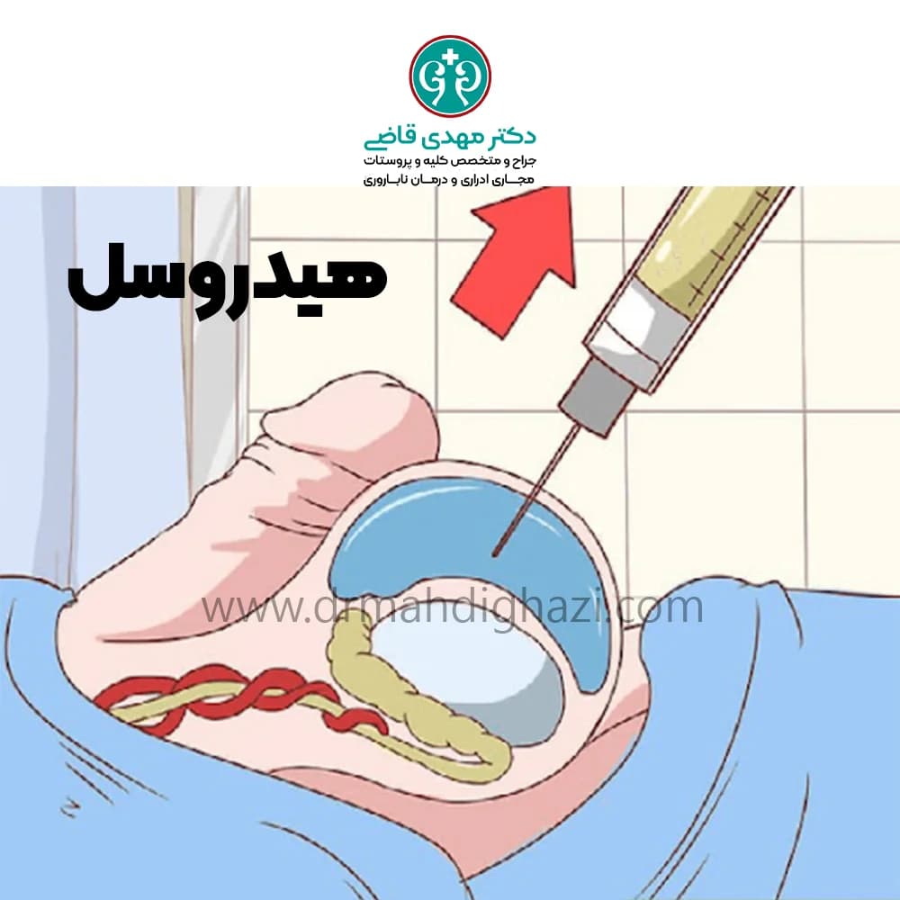 الدكتور مهدي قاضي-هیدروسل چیست