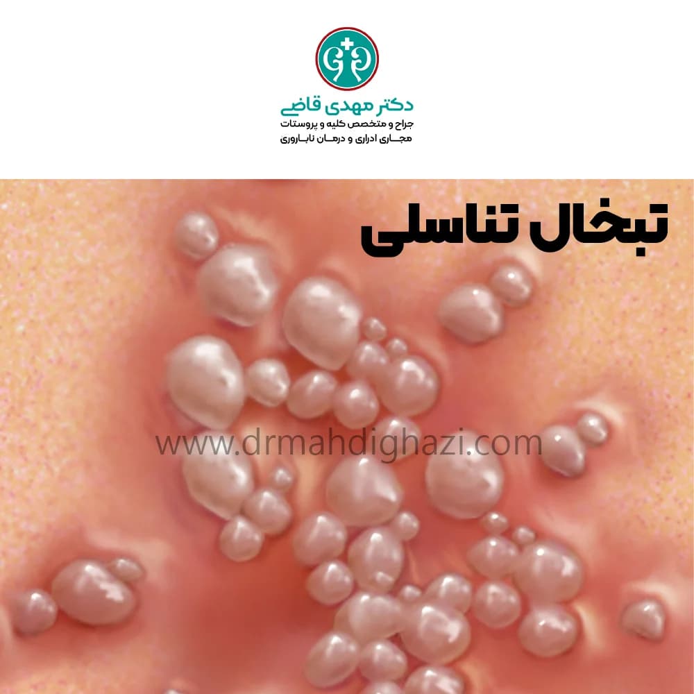 الدكتور مهدي قاضي- تبخال تناسلی