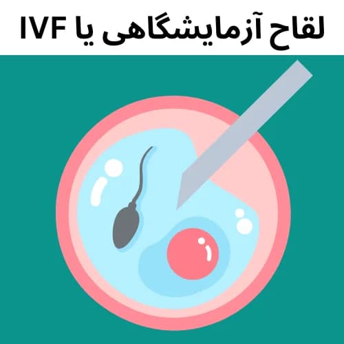 What Is IVF? A Guide to In Vitro Fertilization