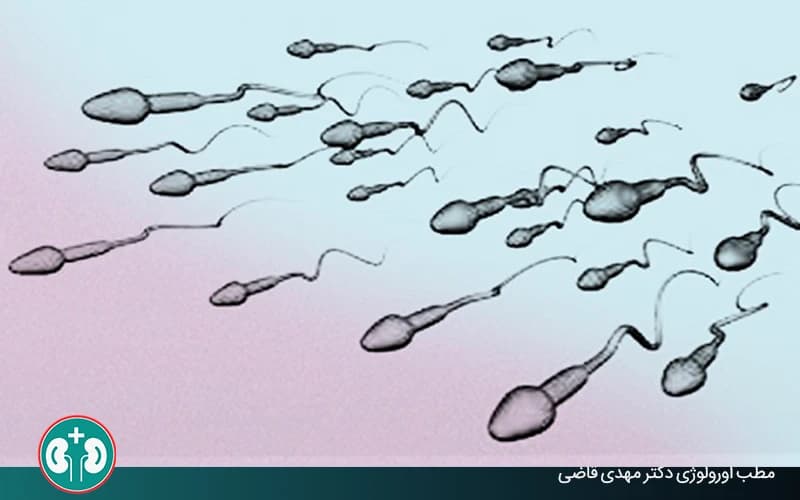 آیا زود انزالی در مردان باعث ناباروری میشود؟
