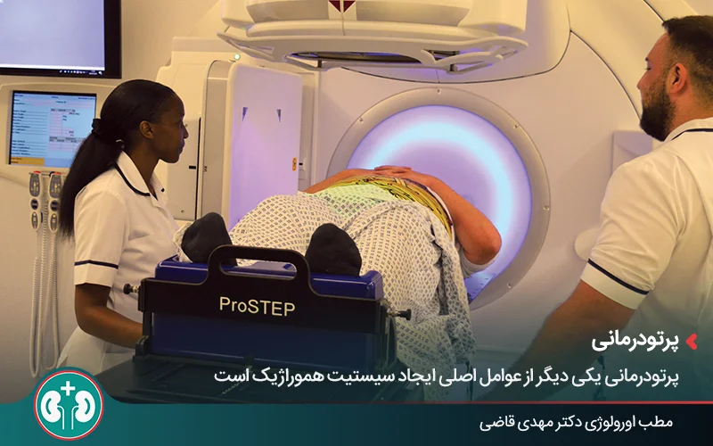صورة لرجل يتلقى علاجًا إشعاعيًا خارجيًا لمنطقة الحوض