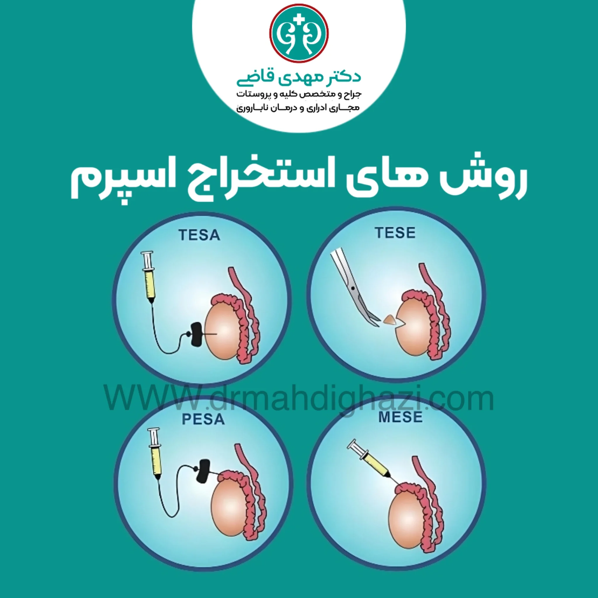 دکتر قاضی-روش های استخراج اسپرم