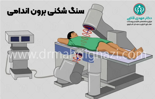 دکتر قاضی- کیست کلیه: علل، علائم، تشخیص و روش‌های درمان