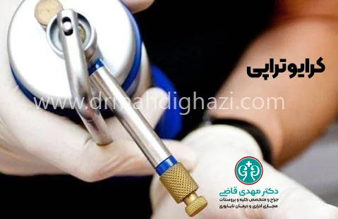 دکتر قاضی-مولوسکوم تناسلی درمان